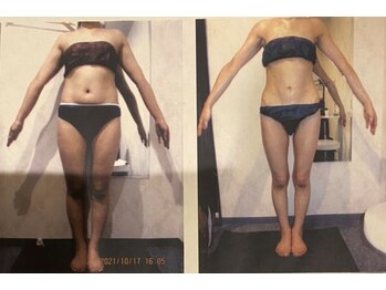 パーフェクトボディプレミアム 名古屋栄店(PERFECT BODY PREMIUM)/お客様 ビフォーアフター(32)