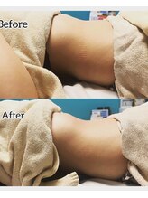 トータルビューティーアンドウィズ(total beauty&WITH)/心と体デトックス腸もみ