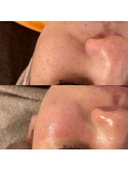 ラナ 京都西院店(Lana)/くすみのない美白肌に導きます