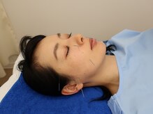 曙橋なかえ鍼灸治療院