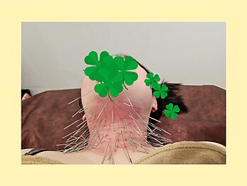 はりきゅう和 ルート鍼灸院/喉の施術