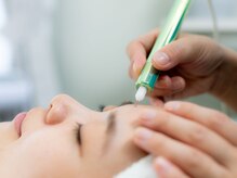 リンバー(Rinver)/シミケア