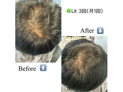 リノア(Lino’a)の写真