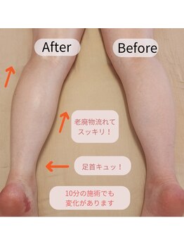 インナーライト(Inner-Light)/*Before&After*
