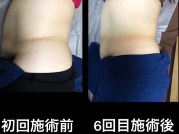 ブランナンバーセブン(Blanc no.7)/引き締めたい方！メリハリボディ