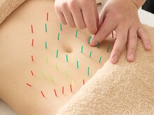 アンドリードット 堀江(&re.)/美腸鍼