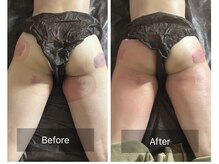 ラ ブリエ(La Briller)/ヒップアップ施術♪