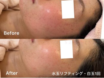 サロンヴェアリー 広尾(salon vary)/敏感肌でもできる肌管理