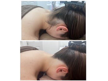 ミース 北九州店/◇うなじビフォーアフター◇