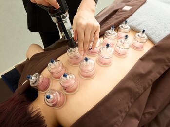 Re:treat HARi 大阪梅田院【鍼灸/ヘッドスパ/オイルマッサージ】【リトリートハリ】/カッピング施術も