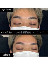 ユー 千葉駅前店(you)/ビフォ－アフター写真