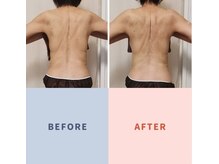 ルビーサロン(ruby-salon)の雰囲気（【つらい部位重点的に】頭痛、巻き肩、猫背、姿勢、筋膜リリース）