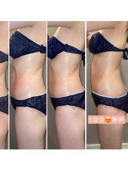 久遠(kuon)/痩身・健康・美を実現!