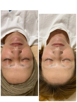 プレジール(Plaisir)/高保湿ウルトラ美白!!