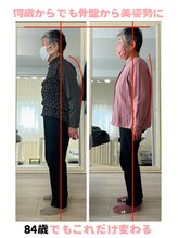 リスリム(Re:slim)/猫背は直せる！