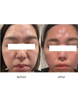 エミニナル(EMININAL)/【フェイシャル】変化