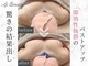 エーアイビューティー 御徒町店(Ai Beauty)の写真
