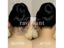 ラヴィソン(ravissant)