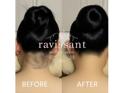ラヴィソン(ravissant)の写真