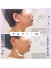 ジャーニー(Journey)/アジャスト3Dフェイシャル