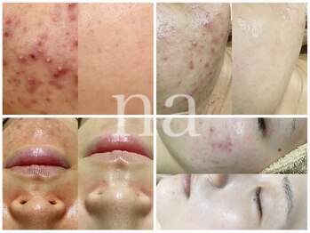 エヌエー 米子店(na)