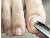 ネイルサロンルーミー(ROOMY)/フットケア（フットネイルケア）