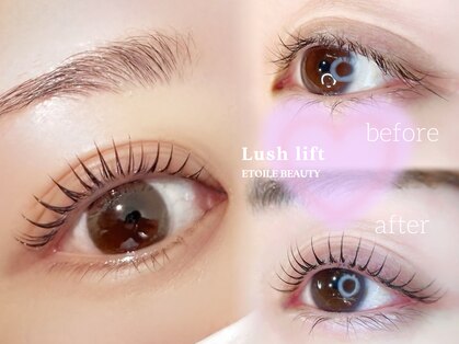 エトワールビューティー(ETOILE BEAUTY)の写真