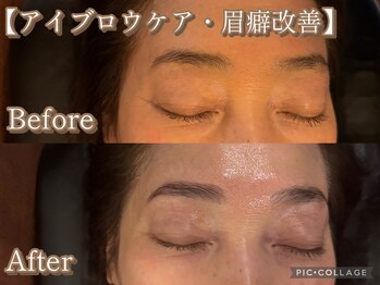 ボディリカバリー(Bodyリカバリー)/