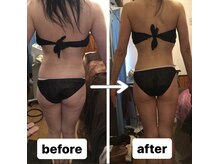 アンリール 旭川店(Anrire)/後ろ姿のビフォーアフター