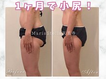 マリスステラ 天王寺(MarisStella)/1ヶ月でお尻もキュッ！