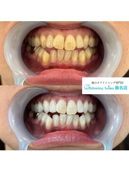 ホワイトニングサロン 三重県桑名店/ホワイトニング/ホワイトニング