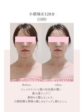 トゥインクル 麻布(twinkle)/港区南麻布/小顔矯正/ヘッドスパ