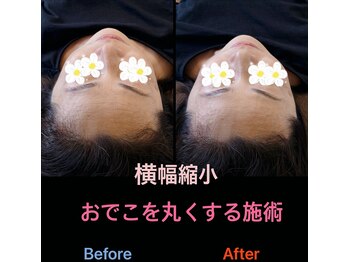 美容矯正サロン レレポノ(LELEPONO)/