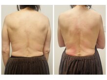 ヨサパーク プラム(YOSA PARK Plum)/before★after