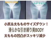 アルページュ(Arpege)/気になる夏ミカン凹凸を減少！