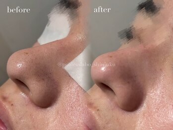 ポアレスラボ 新宿マルイ本館店/お客様ビフォーアフター