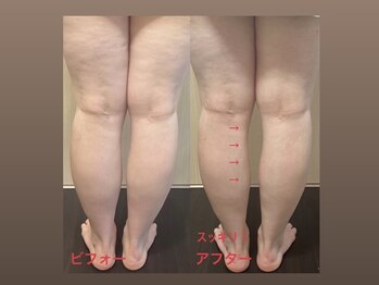 メグサロン(megu salon)/むくみ知らずのスッキリ足に！