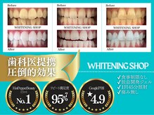 ホワイトニングショップ 鈴鹿店