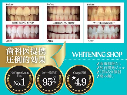 ホワイトニングショップ 鈴鹿店の写真