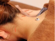 アネラ鍼灸整体院(Anela鍼灸整体院)