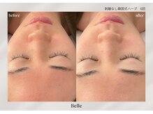 ベル 新橋(Belle)/ハーブピーリング | 毛穴・赤み