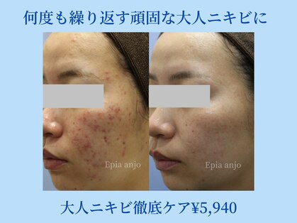 エピア 三河安城店(Epia)の写真