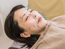 熊本鍼灸小雀斎/美容はり