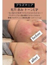 ビューティーネイル(Beauty Nail)/プラズマニア