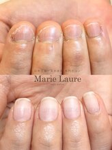 マリーロール 天王寺店(Marie Laure)/深爪改善/自爪育成/ネイルケア