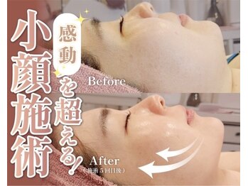 ウィンウィン 新山口店(Win Win)/肌質改善トリートメント