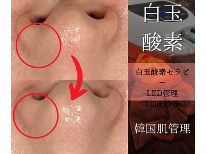 ベガ(Vega)の写真