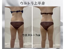 フルーア(FULUA)/ウルトランスフォーマー上半身