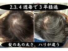 セントラル鍼灸院リラクシー(Re:laxy)/途中離脱しないで継続したおかげ