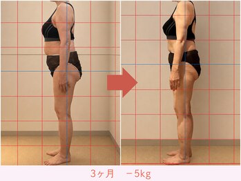 ビューティーエディットラボ(Beauty Edit Lab)の写真/「ただ痩せるだけじゃない」“歪みから整えて変わる”本格痩身サロン